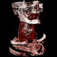 Computed Tomography educational video